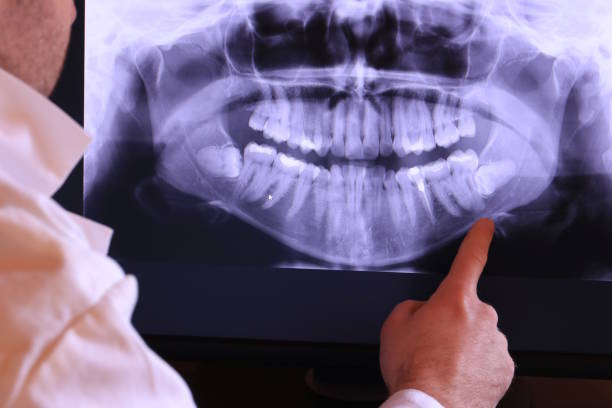 Best Chipped Tooth Repair Near Me  in West Lafayette, OH